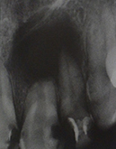 Пациент стоматологии «Эскулап»