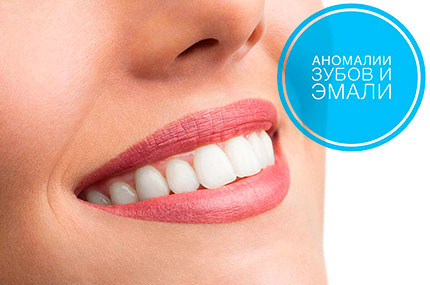 Аномалии зубов и эмали