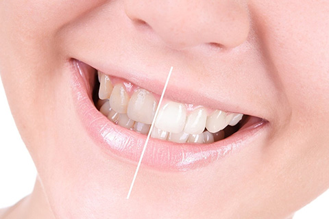 Чем белее зубы, тем они здоровее?