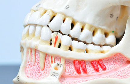 Что такое настоящие зубы?